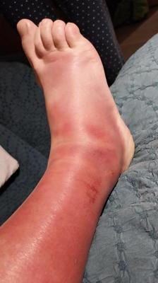 21-06-2024 Stevenson étape 2