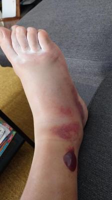 21-06-2024 Stevenson étape 2